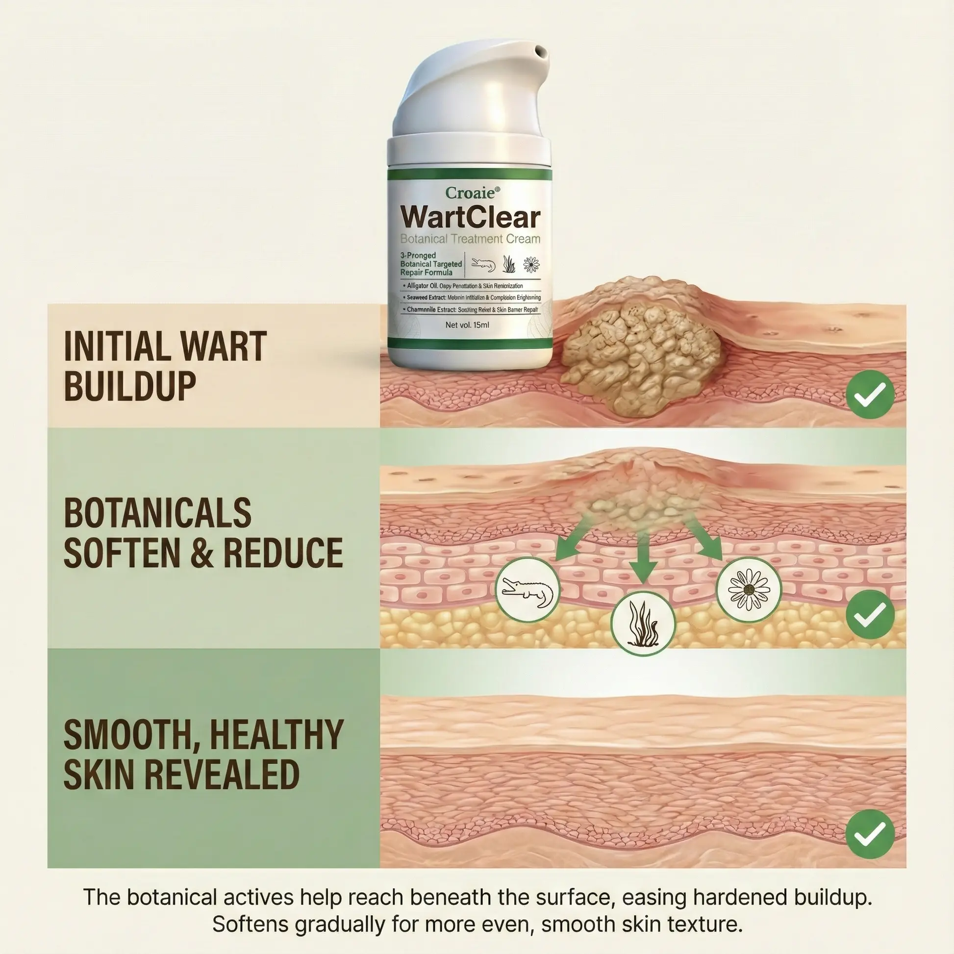 Croaie® WartClear Botanical Treatment Cream
