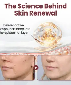 Croaie® BLACK RICE DUAL-ACTION RENEWAL CREAM