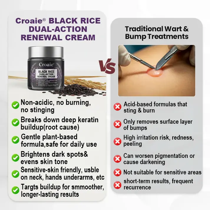 Croaie® BLACK RICE DUAL-ACTION RENEWAL CREAM